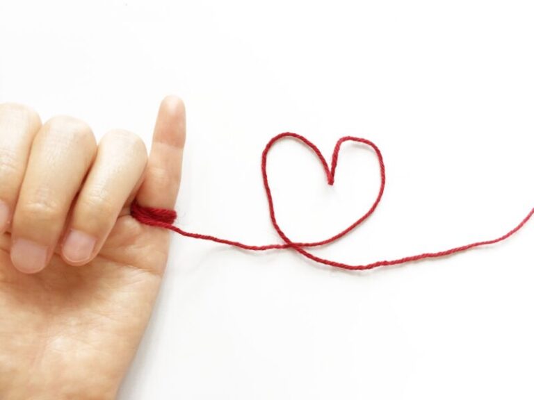 セルビス,赤い糸